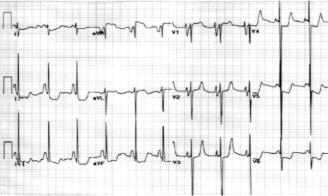 Fig. 2