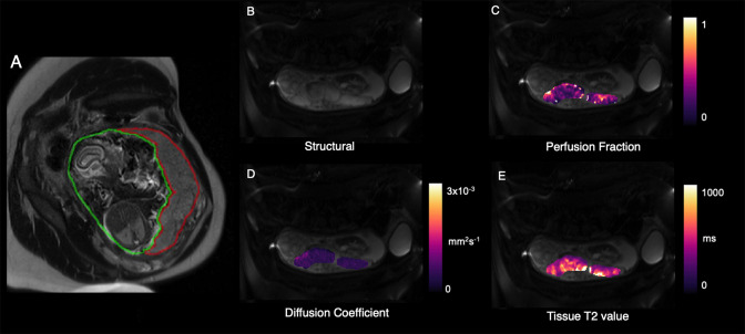 Figure 6.