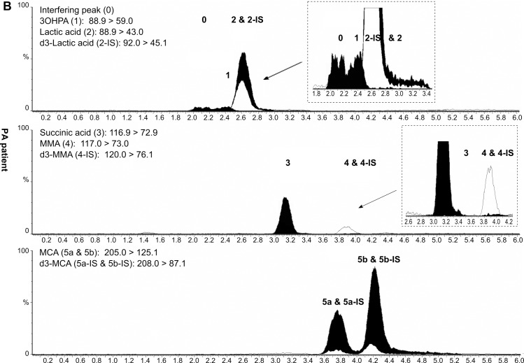 Simultaneous Determination Of Hydroxypropionic Acid Methylmalonic Acid And Methylcitric Acid