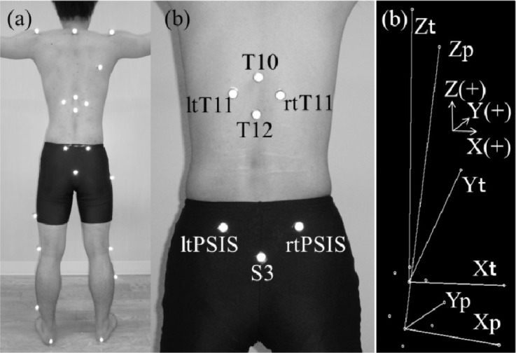 Three-Dimensional Motion Analysis of Lumbopelvic Rhythm During Trunk ...