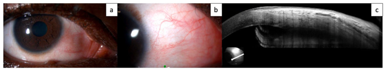 Fig. 4