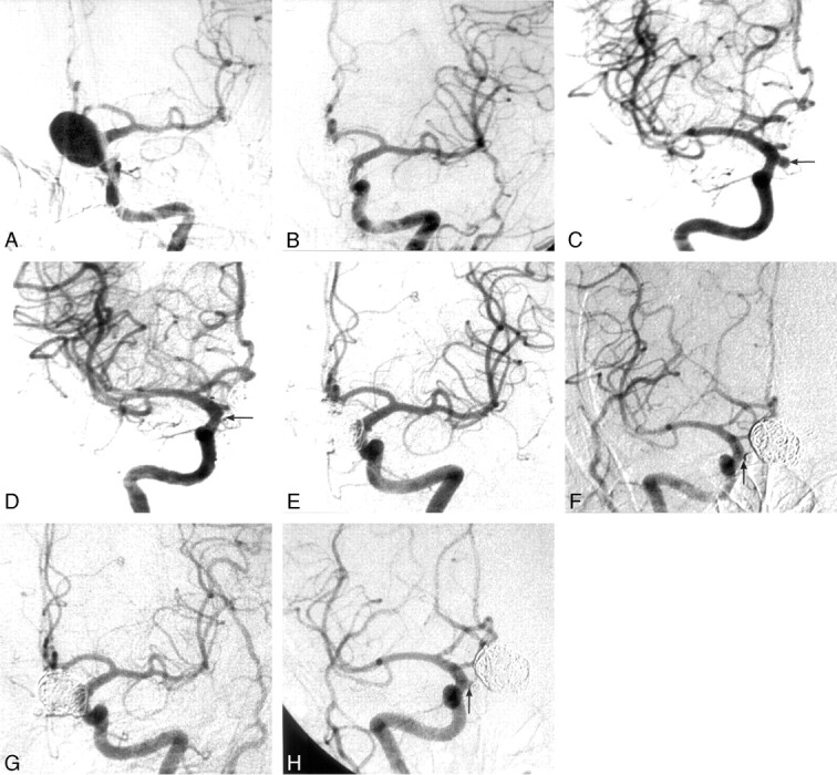 Fig 2.