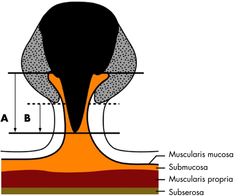 graphic file with name cp43539.f2.jpg