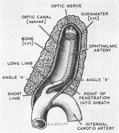 graphic file with name brjopthal00410-0006-a.jpg