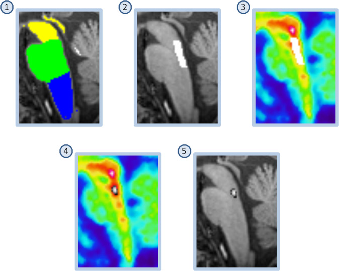 Fig. 2