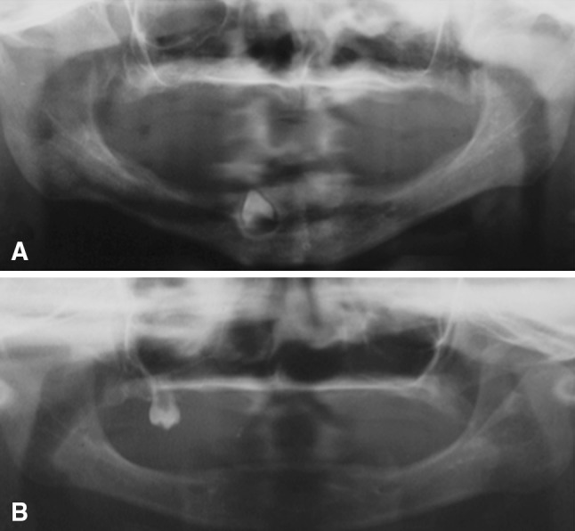 Fig. 4