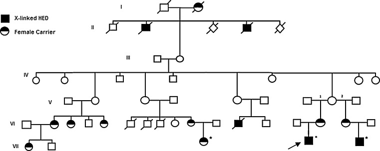 Fig. 1