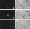 Fig. 11.
