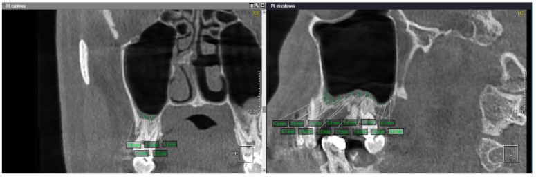 Figure 10