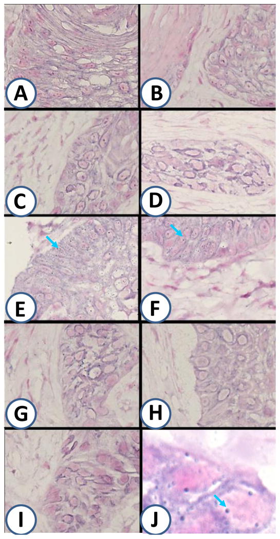 Fig.2