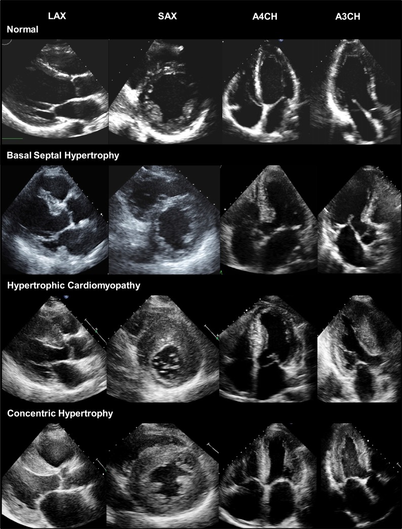 Fig. (1)