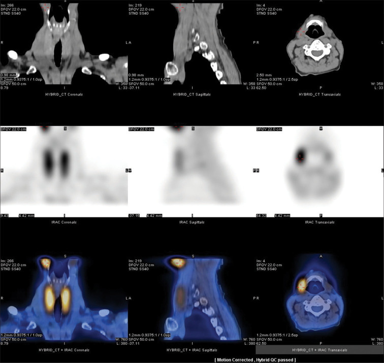 Figure 2: