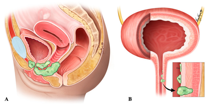 Figure 16