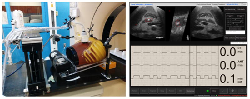 Fig. 11