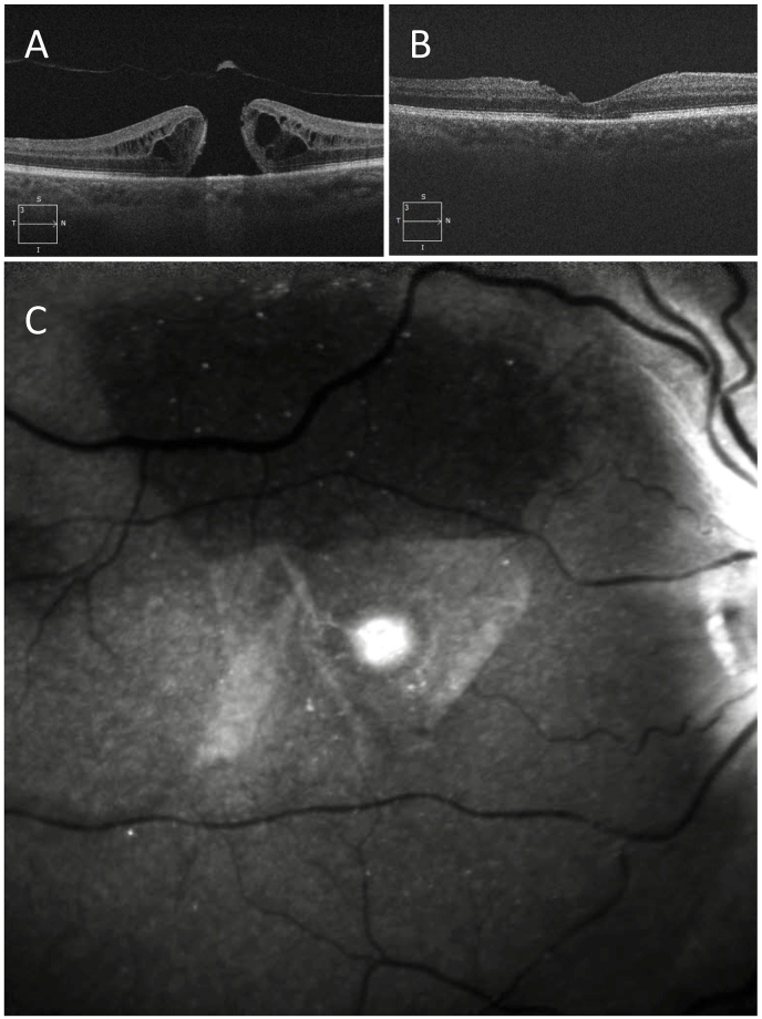 Fig. 3