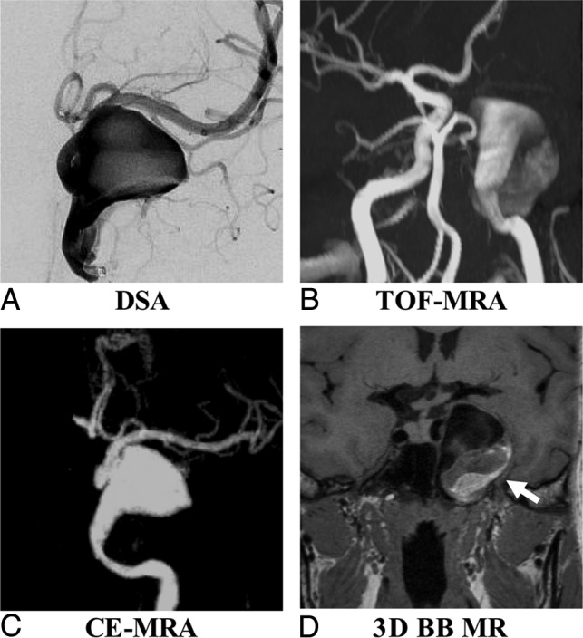 Fig 4.