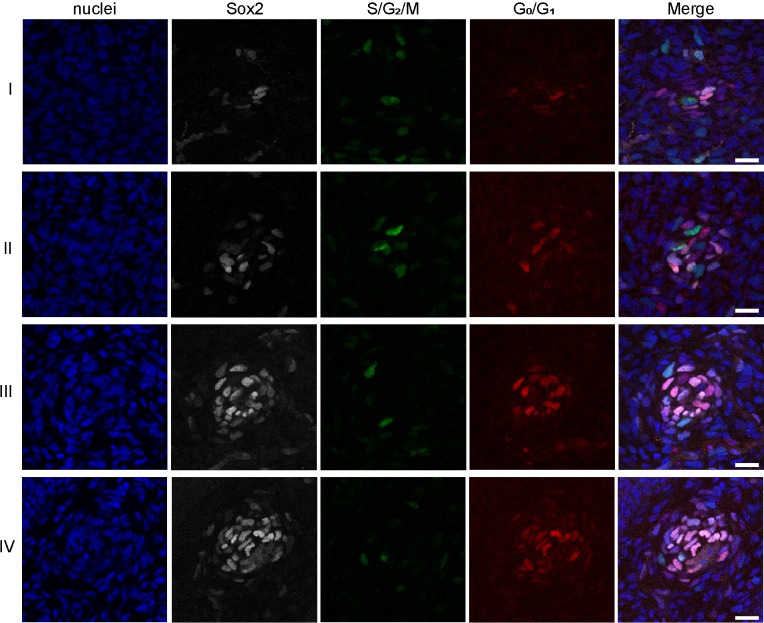 Figure 3—figure supplement 1.