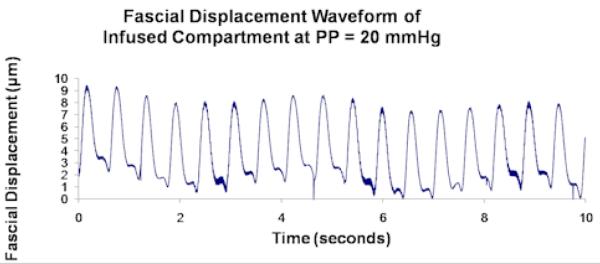 Figure 2.2