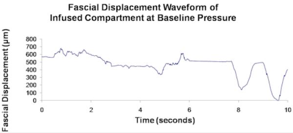 Figure 2.3