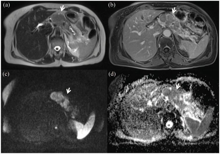 Figure 2.