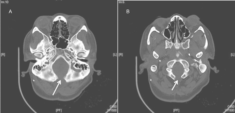 Fig. 3