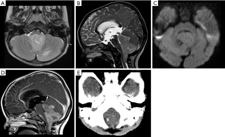 Figure 16