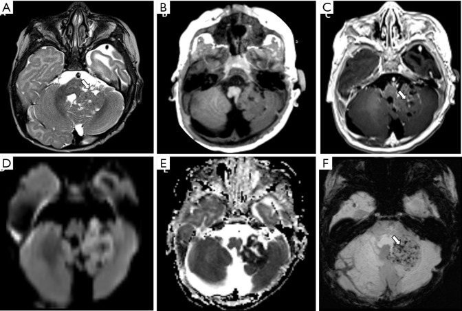 Figure 14