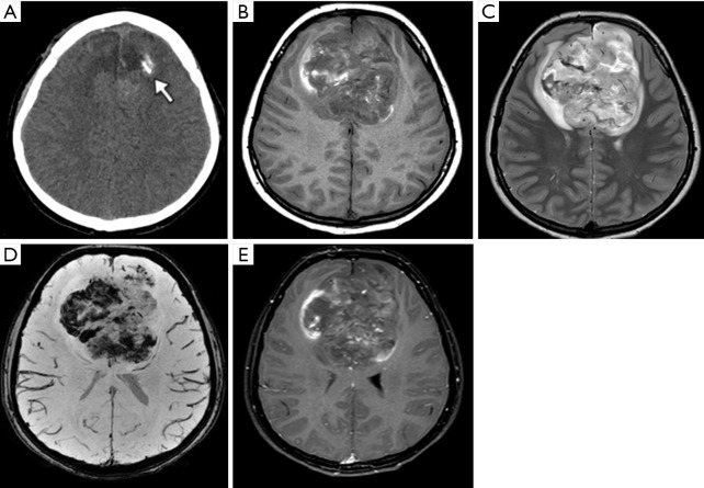 Figure 15