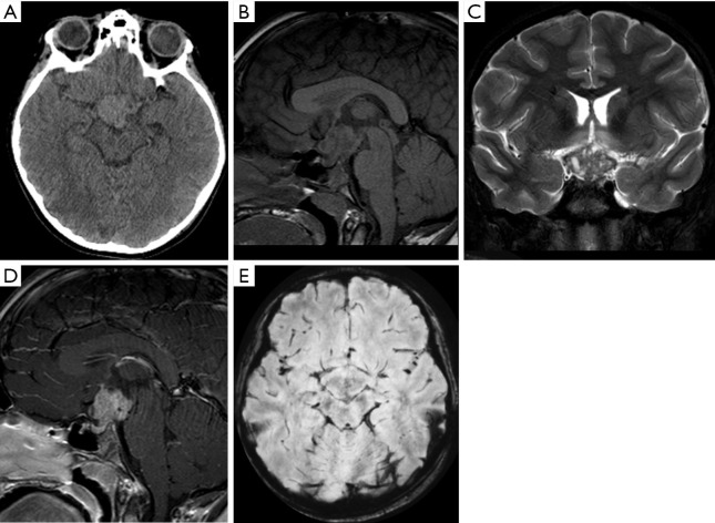 Figure 18