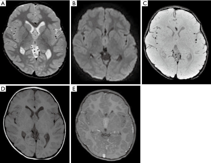 Figure 17