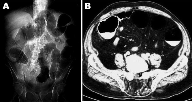 FIG 1