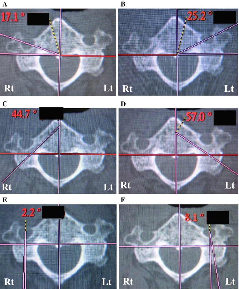 Fig. 2