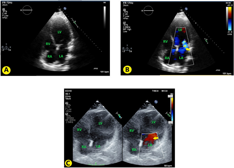 Figure 2