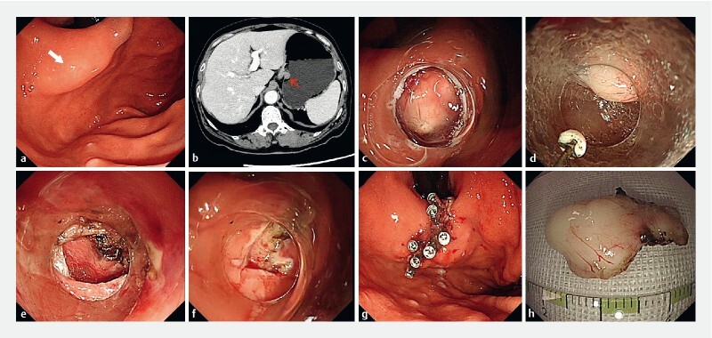 Fig. 1 a