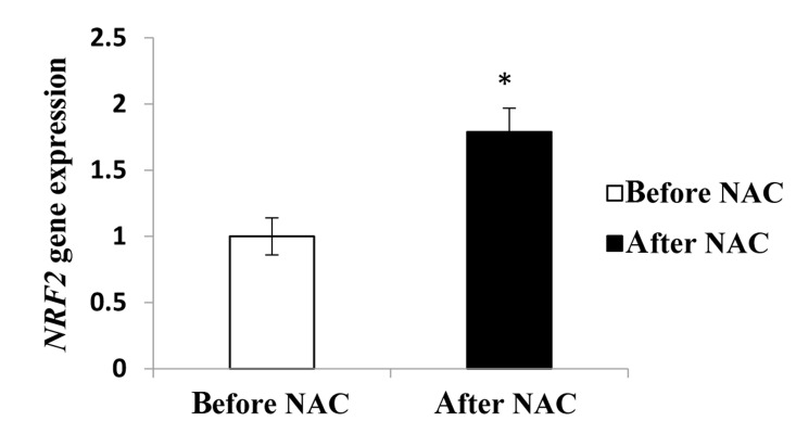 Fig.2