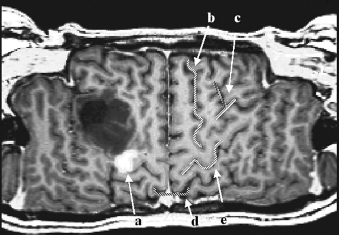 Fig 4.