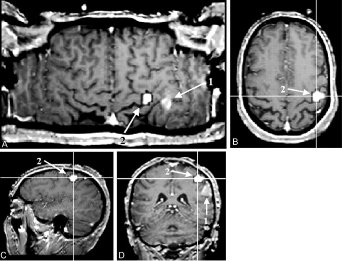 Fig 5.