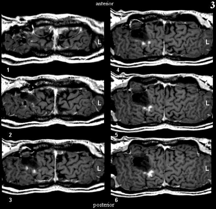 Fig 3.