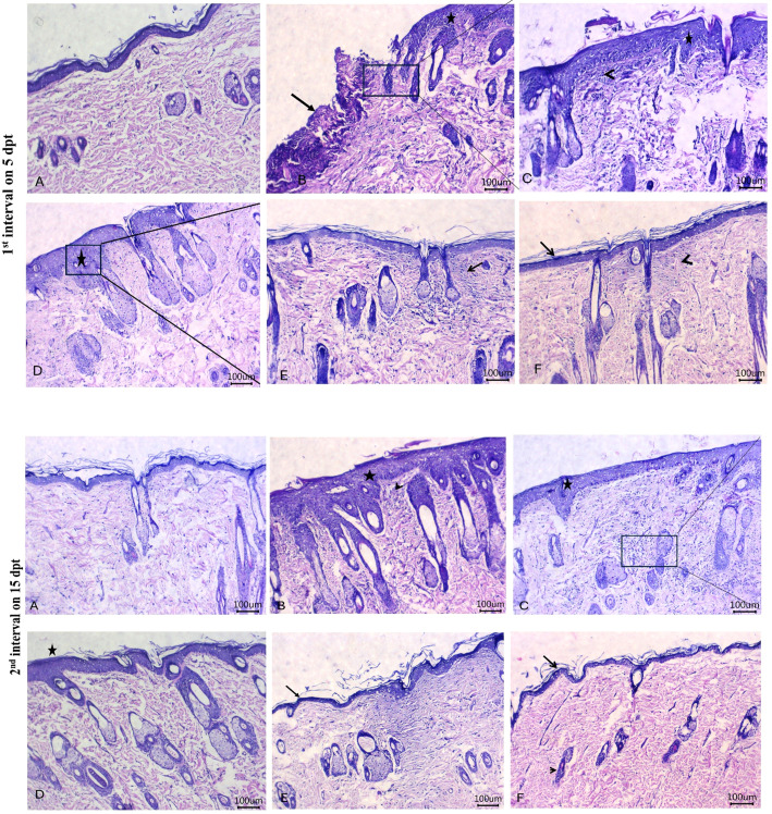 Figure 11