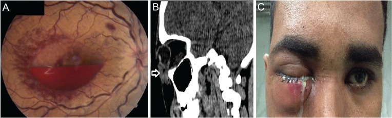 Fig. 1