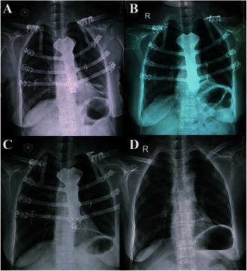 Fig 3