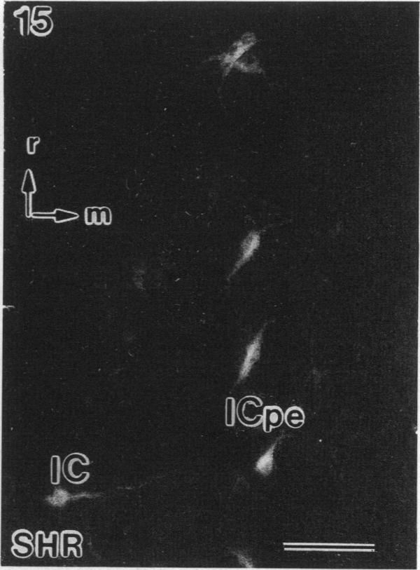 Fig. 15