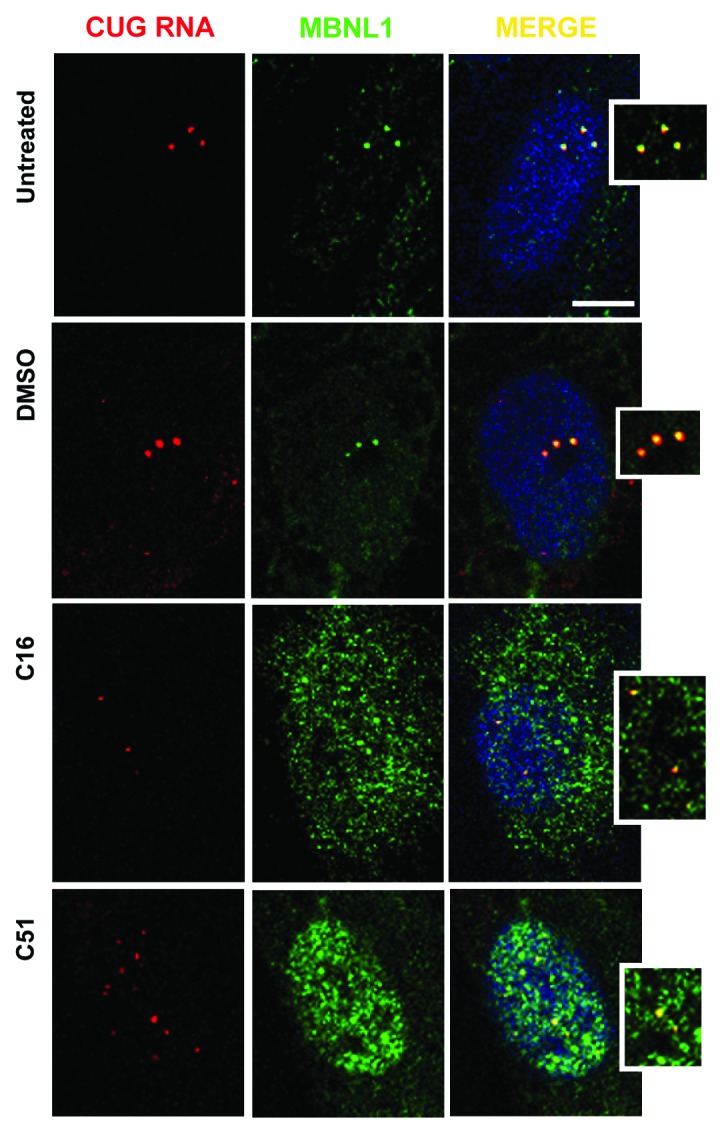 graphic file with name rna-11-742-g5.jpg