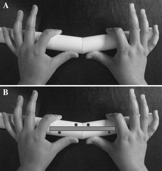 Fig. 1