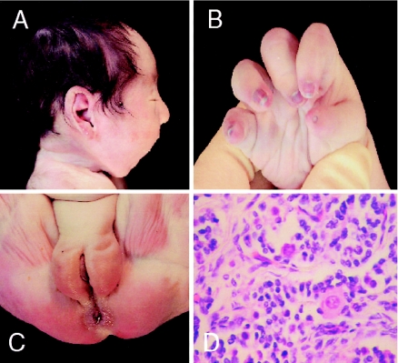 Figure  3