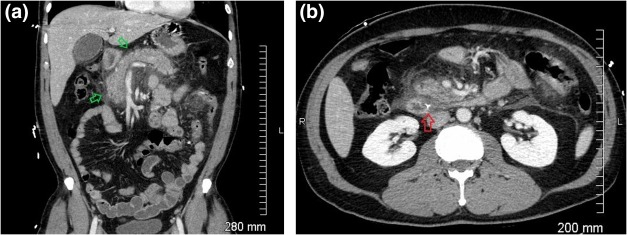 Figure 11