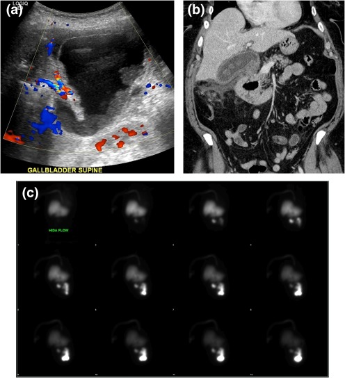 Figure 12