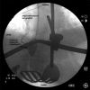 Fig. 3