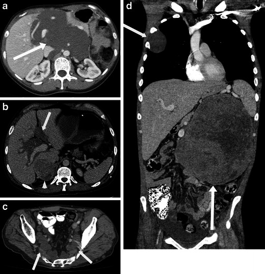 Fig. 13