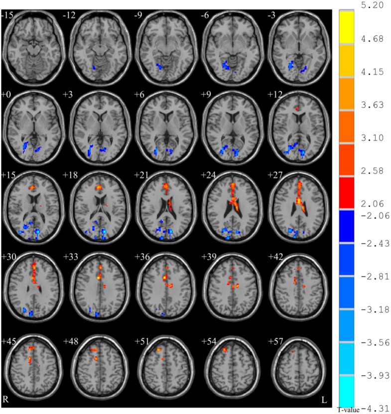 Fig 1